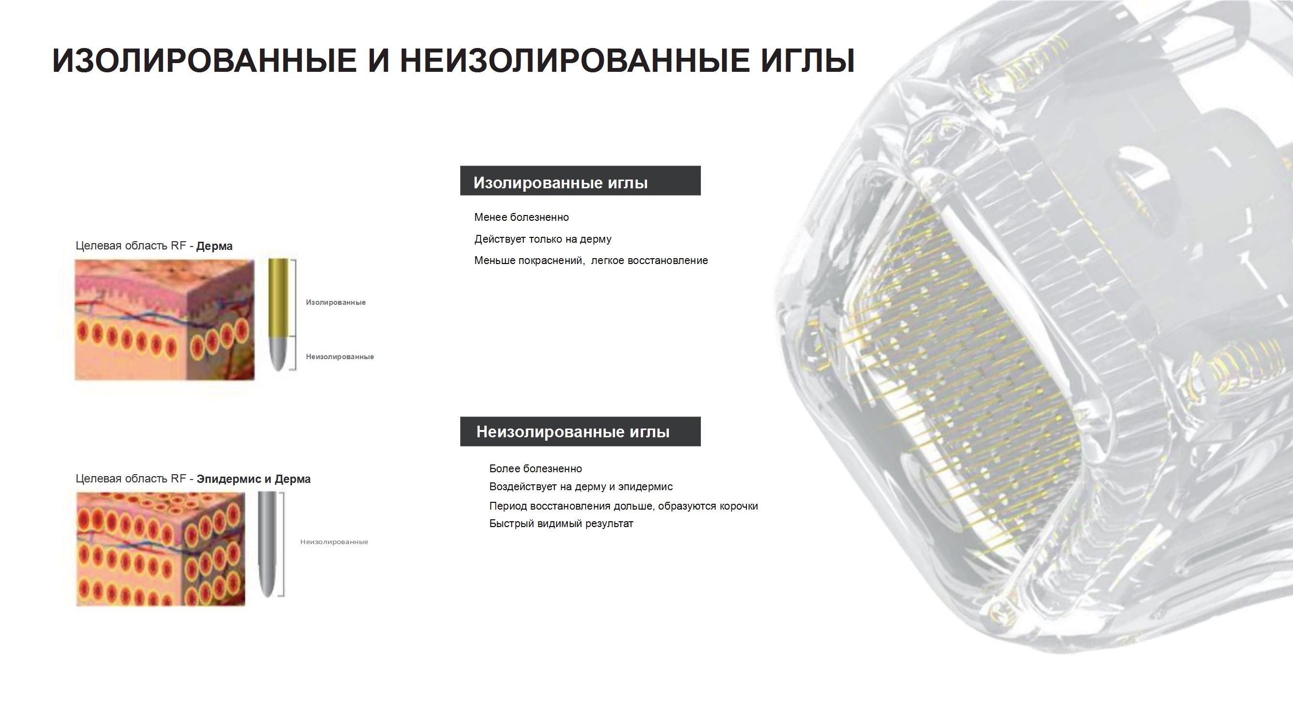 Технология изолированных и неизолированных игл